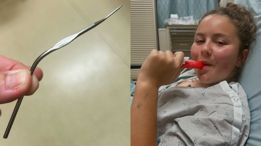 En un desafortunado accidente que ha dejado muchos con la boca abierta una niña de 12 años de Oceanside, California (EEUU), sufrió una lesión inesperada mientras buscaba un audífono perdido en su hogar.