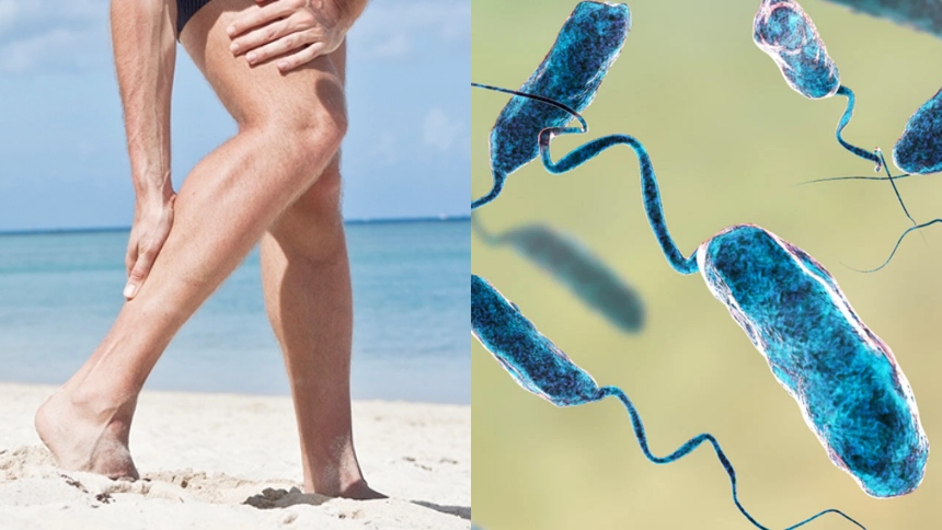 La bacteria “come carne”, conocida científicamente como Vibrio vulnificus, ya aterroriza a gran parte de los ciudadanos en EEUU por el aumento de casos graves y muertes en lo que va del año.  