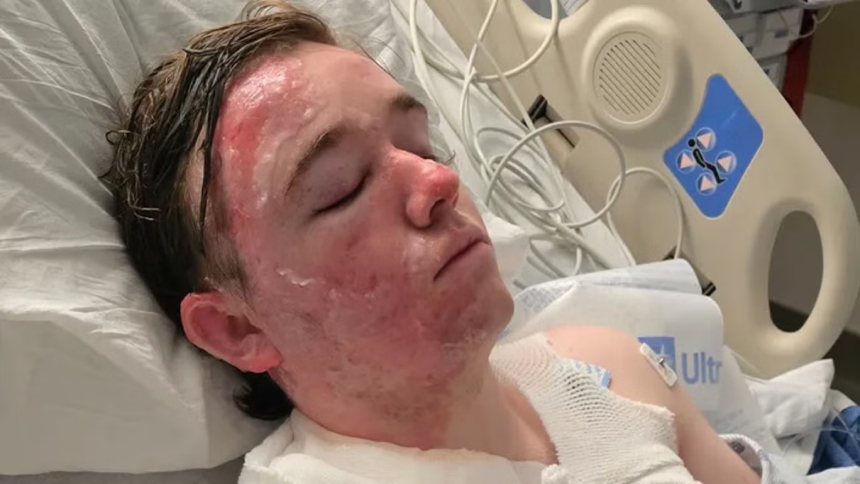 Un gerente de un restaurante de McDonald's en California permanece en estado crítico tras sufrir quemaduras de segundo grado luego de que, presuntamente, una compañera de trabajo le arrojara aceite caliente dentro del local en Yuba City, en un violento episodio que generó conmoción en Estados Unidos. 