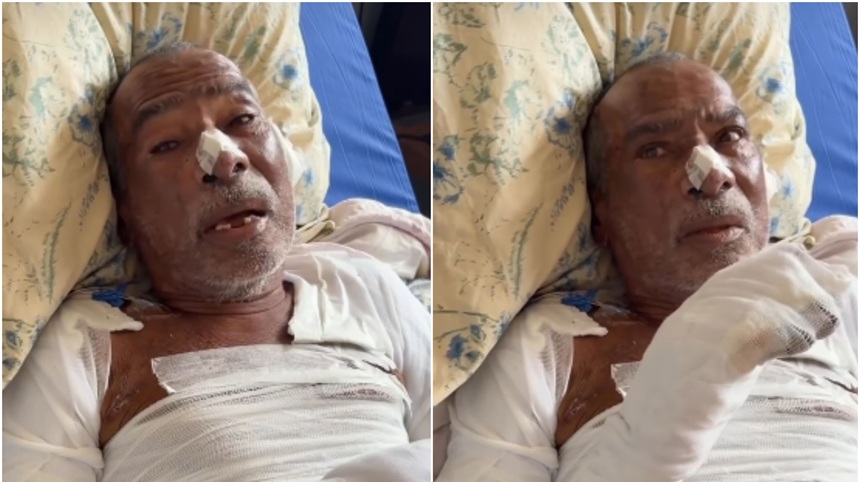 El anciano de 77 años, pidió a la autoridades que atrapen a los responsables de sus lesiones. Foto capturas de video Instagram Noticias Oriente.